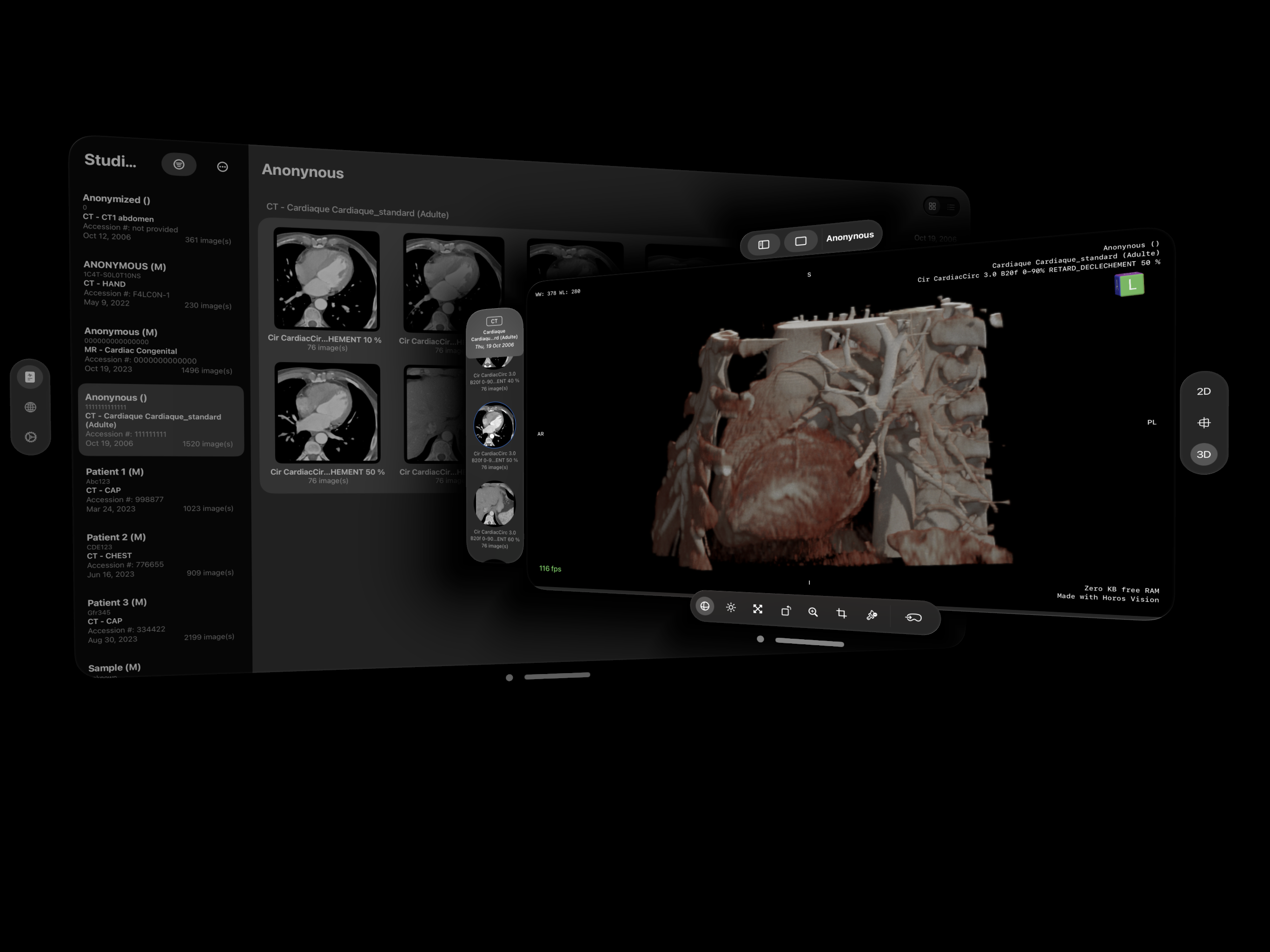 Falcon Vue immersive imaging controls